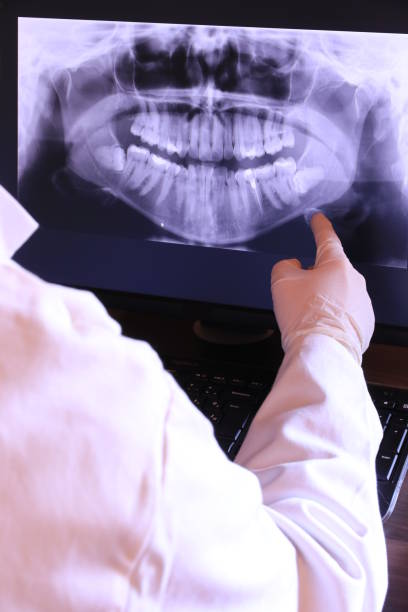 Best Emergency Denture Repair in Portsmouth, OH