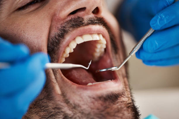 Best Emergency Cosmetic Dentistry (e.g., broken veneers) in Portsmouth, OH